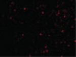 IKAP Antibody in Immunocytochemistry (ICC/IF)