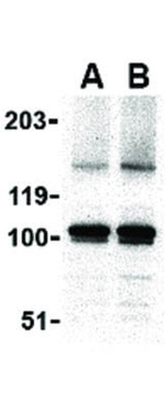 IKAP Antibody in Western Blot (WB)