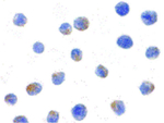 IKK alpha Antibody in Immunocytochemistry (ICC/IF)