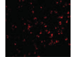IKK alpha Antibody in Immunocytochemistry (ICC/IF)