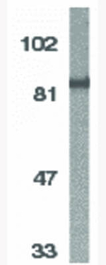 IKK alpha Antibody in Western Blot (WB)