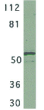 IKK gamma Antibody in Western Blot (WB)