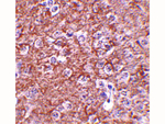 IL-16 Antibody in Immunohistochemistry (Paraffin) (IHC (P))