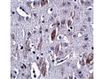 IL-16 Antibody in Immunohistochemistry (Paraffin) (IHC (P))
