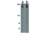 IL-17 Antibody in Western Blot (WB)
