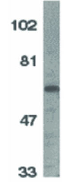 IL-1RAcP Polyclonal Antibody