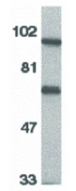 IL-1RAcP Antibody in Western Blot (WB)