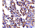 IL-21 Receptor Antibody in Immunohistochemistry (Paraffin) (IHC (P))