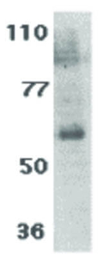 IL-21 Receptor Antibody in Western Blot (WB)