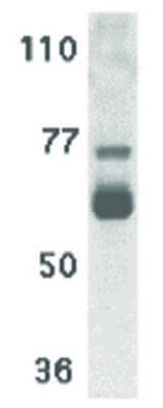 IL-22 Receptor Antibody in Western Blot (WB)