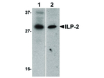 ILP-2 Antibody in Western Blot (WB)