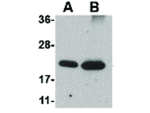 Integrin alpha 4 Antibody in Western Blot (WB)