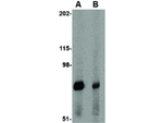 Integrin alpha 4 Antibody in Western Blot (WB)