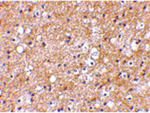 IPR1 Antibody in Immunohistochemistry (Paraffin) (IHC (P))