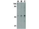 IPR1 Antibody in Western Blot (WB)