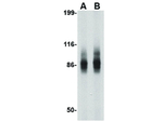 IPR1 Polyclonal Antibody