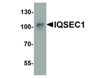 IQSEC1 Polyclonal Antibody