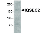 IQSEC2 Polyclonal Antibody
