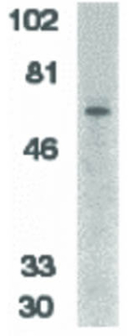 IRAK2 Antibody in Western Blot (WB)