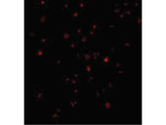 IRE1p Antibody in Immunocytochemistry (ICC/IF)