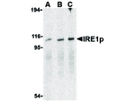 IRE1p Antibody in Western Blot (WB)