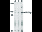 IRE1p Antibody in Western Blot (WB)