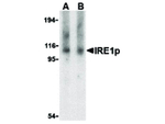 IRE1p Polyclonal Antibody
