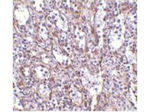 STIM1 Polyclonal Antibody