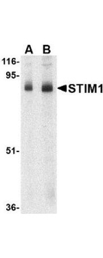 STIM1 Antibody in Western Blot (WB)