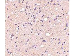 ELOVL6 Polyclonal Antibody