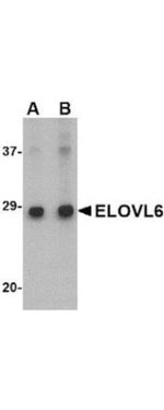 ELOVL6 Antibody in Western Blot (WB)