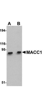 MACC1 Antibody in Western Blot (WB)