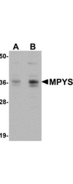 MPYS Antibody in Western Blot (WB)