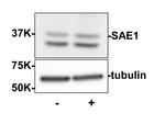 SAE1 Polyclonal Antibody
