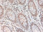 Phospho-STAT3 (Tyr705) Antibody in Immunohistochemistry (Paraffin) (IHC (P))