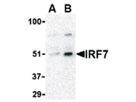 IRF7 Antibody in Western Blot (WB)