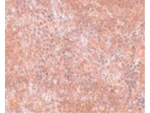 JMJD8 Antibody in Immunohistochemistry (Paraffin) (IHC (P))