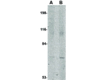 JPH1 Antibody in Western Blot (WB)