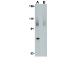 JPH2 Polyclonal Antibody