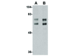 JPH2 Antibody in Western Blot (WB)