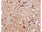 JPH3 Antibody in Immunohistochemistry (Paraffin) (IHC (P))