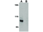 JPH3 Antibody in Western Blot (WB)