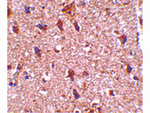 JPH3 Antibody in Immunohistochemistry (Paraffin) (IHC (P))
