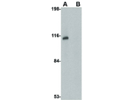 JPH3 Antibody in Western Blot (WB)