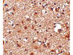 JPH4 Antibody in Immunohistochemistry (Paraffin) (IHC (P))