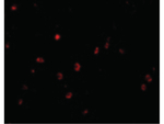 KAI1 Polyclonal Antibody