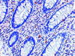 KAI1 Antibody in Immunohistochemistry (Paraffin) (IHC (P))