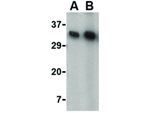 KAI1 Antibody in Western Blot (WB)