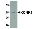 KCNK1 Polyclonal Antibody
