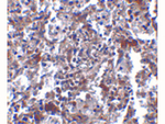 KCTD15 Antibody in Immunohistochemistry (Paraffin) (IHC (P))